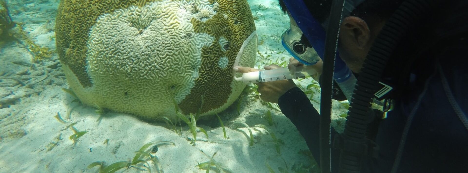 A diver next to a sick brain coral.